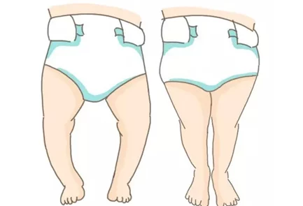 宝贝 腿张大点就不疼了软件:通过调整腿部姿势来缓解疼痛的实用工具,帮助用户改善身体舒适度与健康 宝贝 腿张大点就不疼了软件:通过调整腿部姿势来缓解疼痛的实用工具,帮助用户改善身体舒适度与健康