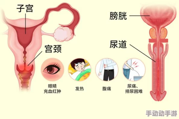 胡桃尿道口流出白色脓状物是什么？了解可能的原因与治疗方法，关心自己的健康尤为重要！