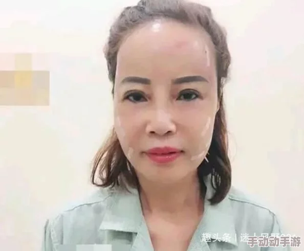极品老妇    BBBB，被曝与多名年轻男星传绯闻，疑似整容频繁现身医美机构